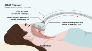 What Is a BiPAP Machine, and How Does it Work? - Visual Information